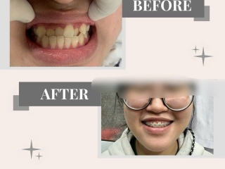 CHĂM SÓC RĂNG MIỆNG THẨM MỸ TOÀN DIỆN TẠI NHA KHOA HIẾU THUẬN – NỤ CƯỜI TỎA SÁNG, SỨC KHỎE BỀN LÂU